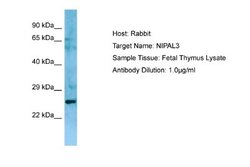 NIPAL3 Rabbit anti-Human, Polyclonal, Novus Biologicals 0.1ml; Unconjugated:Antibodies,